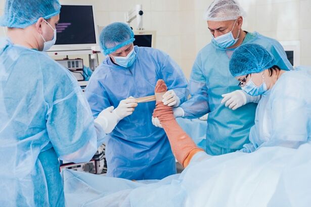 Varopoly operation