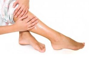 treatment of varicose veins in legs with ointment